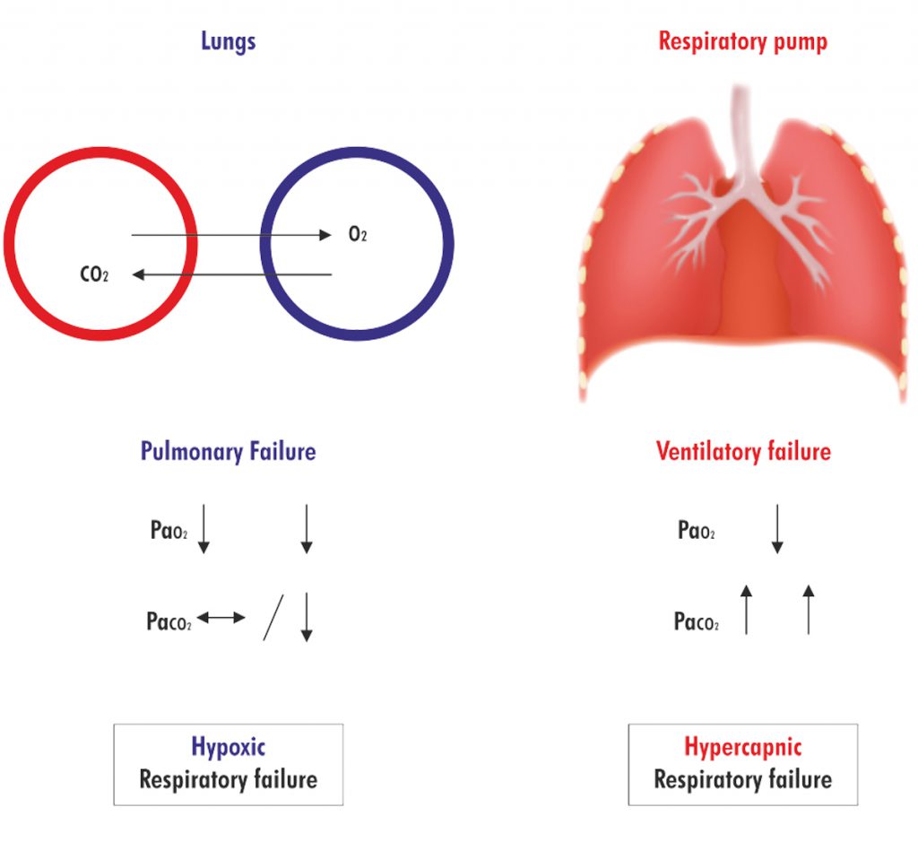 Pathophysiology of RespiratoryFailure - Saans Foundation